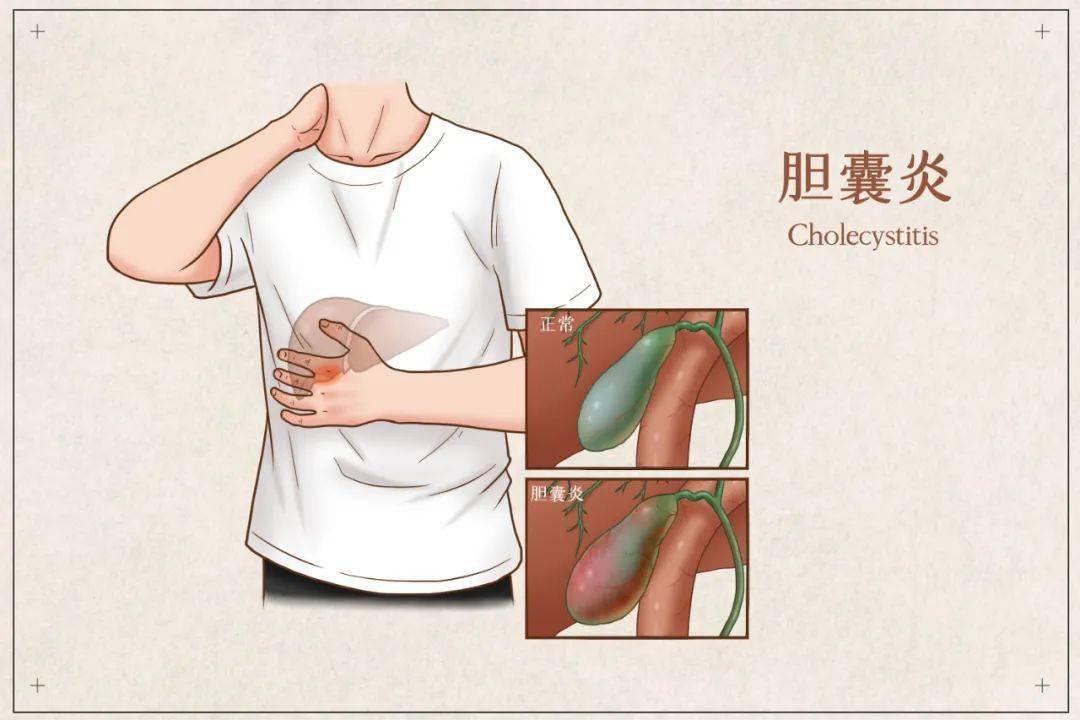 这些情况都会引起腹痛._腹部_十二指肠_肠梗阻