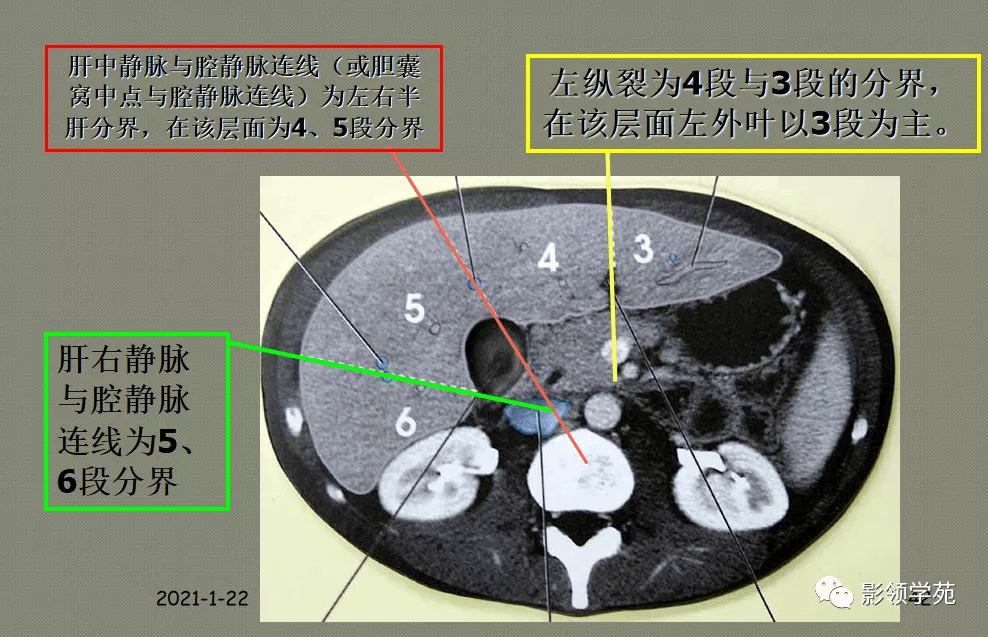 超讚最全肝臟的表面解剖及分葉分段