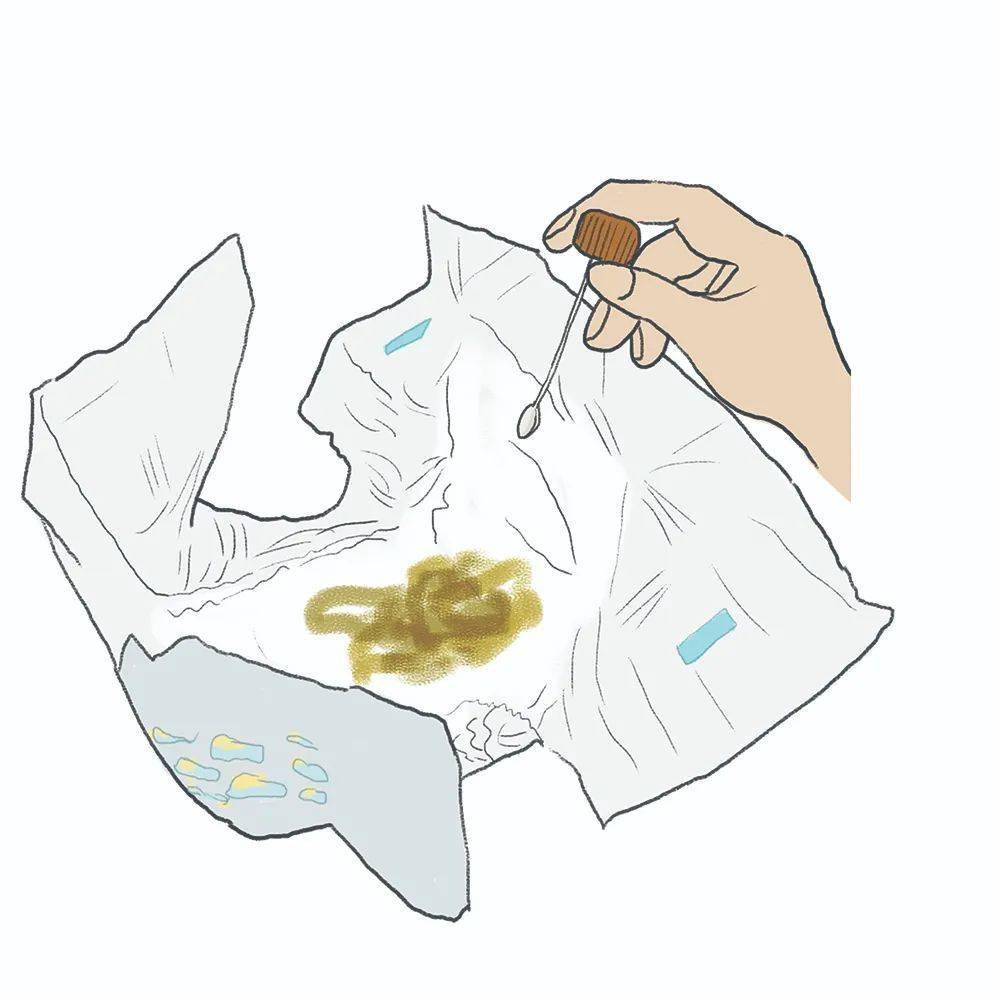 67检查化验,这些"流程"您必须懂_标本_尿液_检验