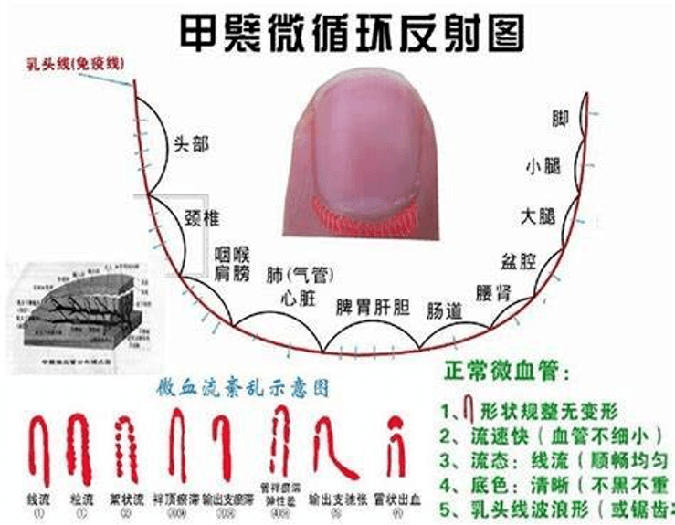 血管呈袢状,是人体内构型最简单的毛细血管,甲襞微循环检测(nvc)可对