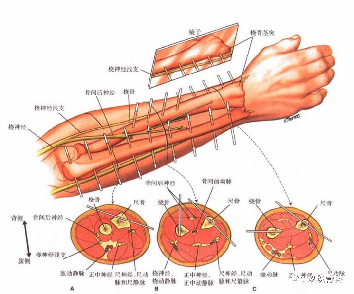 圖文詳解 | 外固定手術入路_神經_肱骨_橈骨