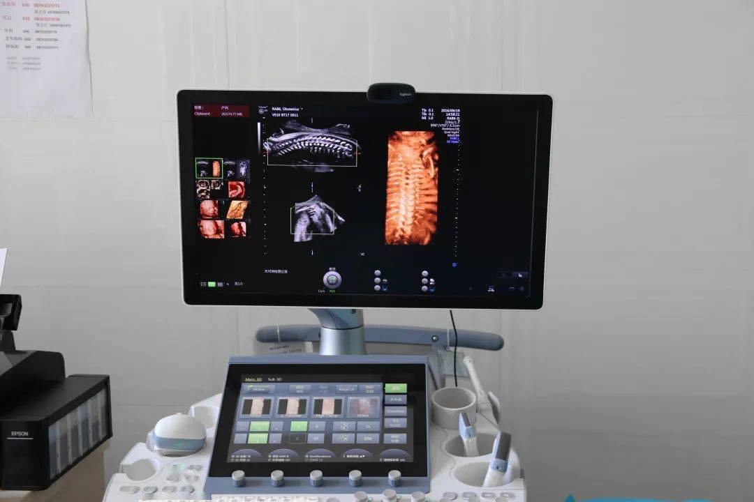 好消息广南县中医医院可以做四维彩超啦