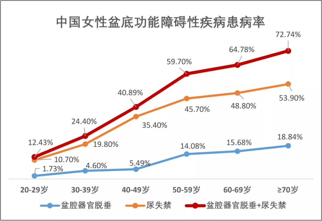 根据国内一项多区域调查表明,我国成年女性ui发病率为30