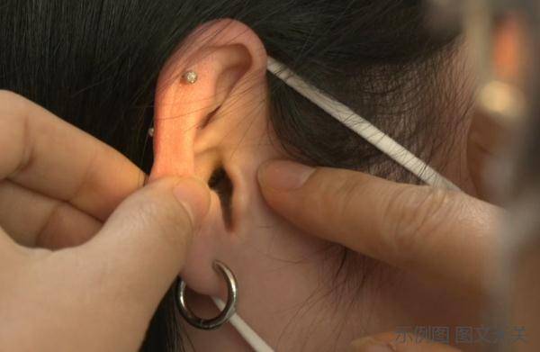 习惯|18岁女孩戴耳机“上瘾”，左耳突然聋了