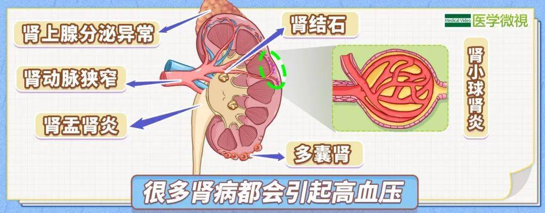 肾脏|想知道肾好不好？来看看这份“测试卷”你能拿多少分