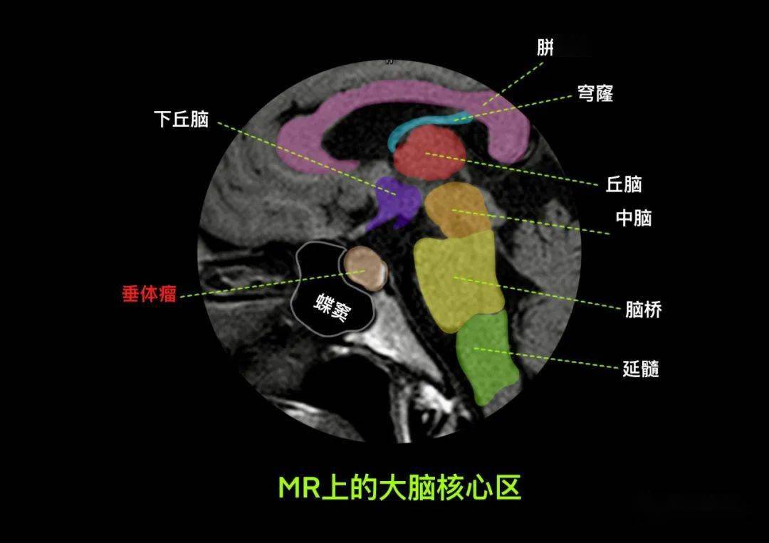 脑血供:颈内动脉系统三,脑血供:椎 