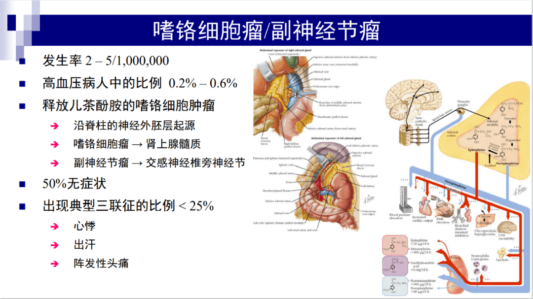 課件分享丨薛張綱教授:嗜鉻細胞瘤和副神經節瘤_仇俊鑫_校對_麗水