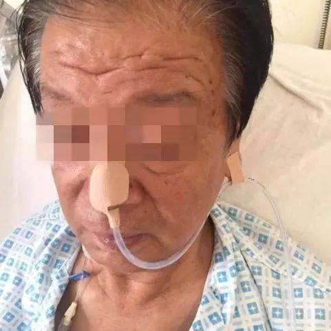 胃管留置，你真的掌握了吗？_患者_长度_临床