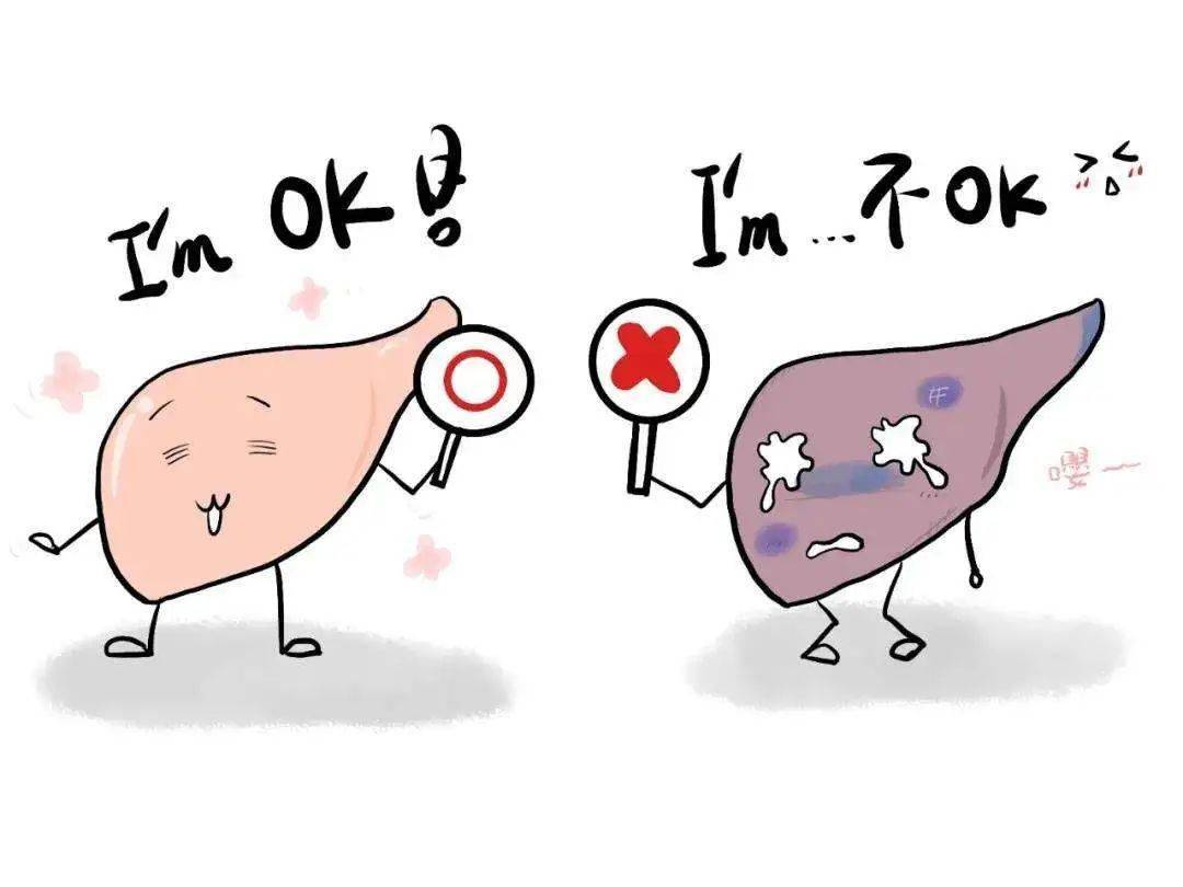 直播预告全国爱肝日科学认识脂肪肝专家教你呵护小心肝