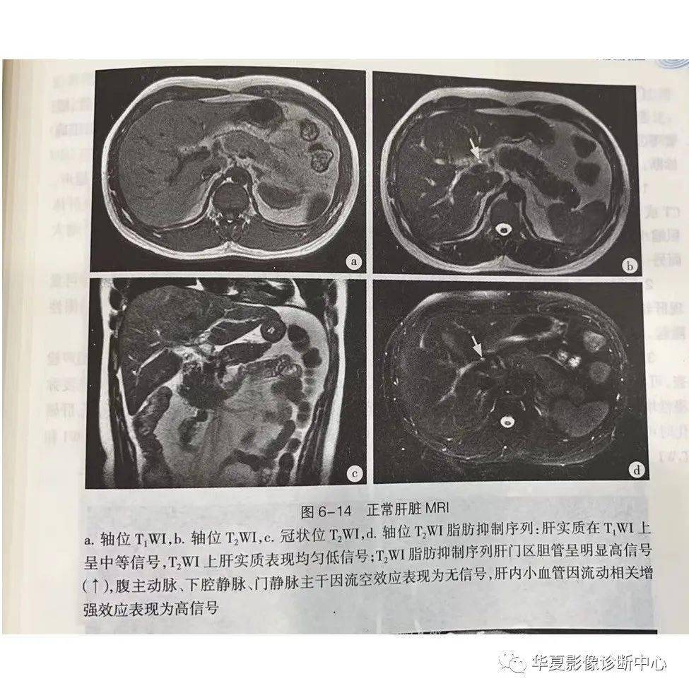 解剖|肝脏影像学与系统解剖