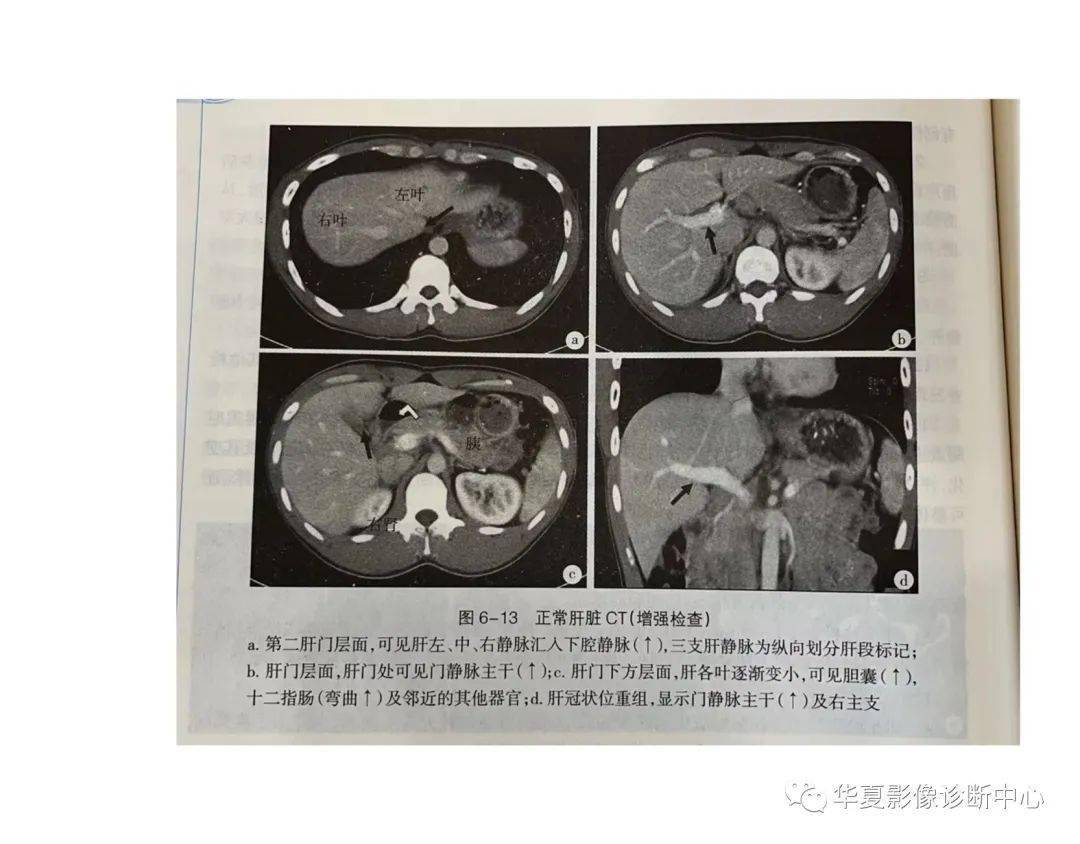 解剖|肝脏影像学与系统解剖