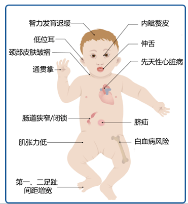 孕育健康宝宝——孕妈妈的唐氏综合征6连问