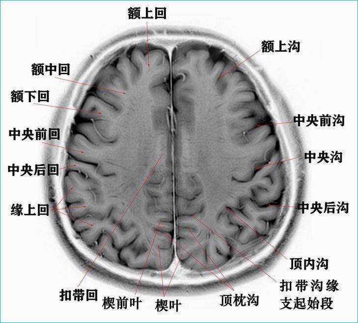 收藏| 高清顱腦斷層解剖圖譜_全網_影像_系統