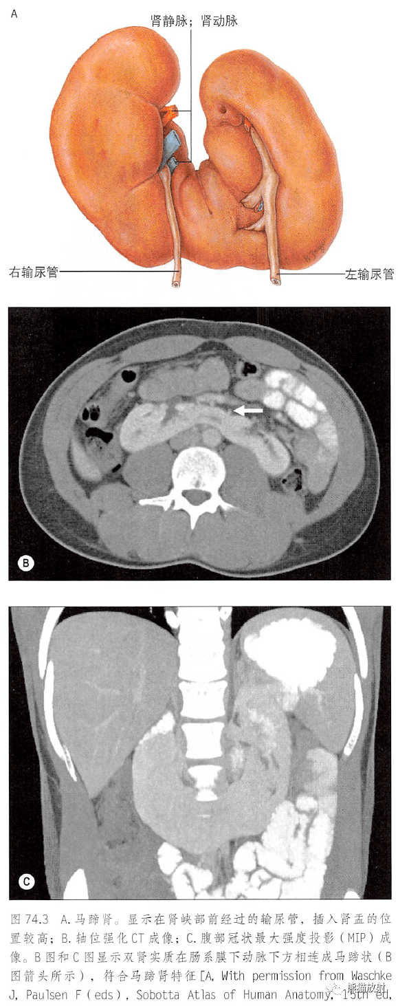 解剖丨脾腎上腺泌尿生殖發育腎和輸尿管