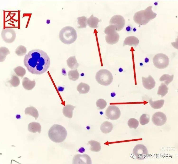 血细胞光镜结构图图片