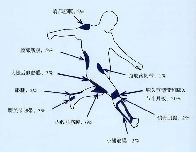 大腿拉伤示意图图片