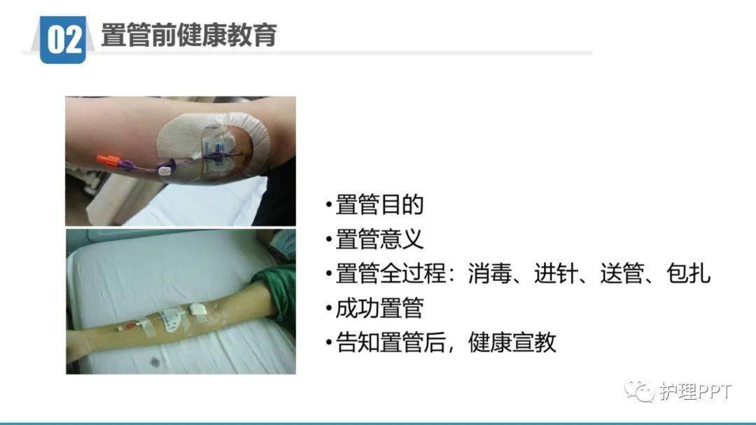 【ppt】picc置管健康教育