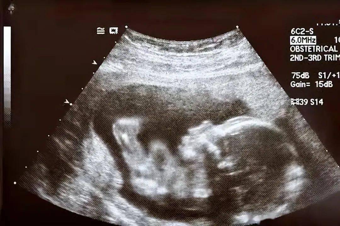 怀孕四个月图片 男女图片