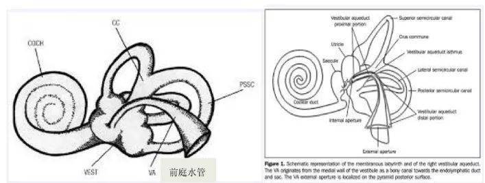 读懂大前庭导水管的解剖及生理