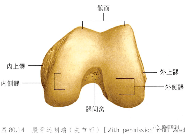 股骨内上髁位置图片