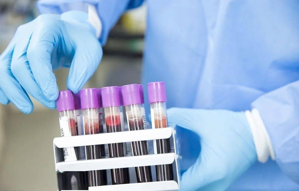 这个指标高了说明机体处于应激状态_血清_疾病_浓度