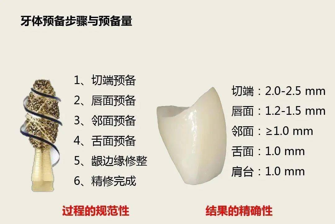 前牙全瓷冠的牙体预备_违规_侵权_版权