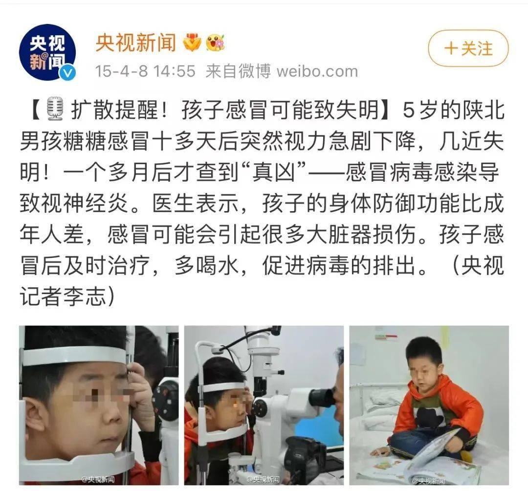 突然视力下降,几乎失明,最终诊断为——感冒病毒感染导致视神经炎