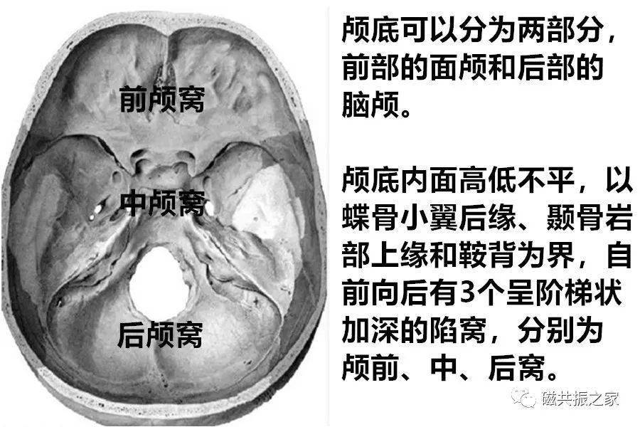 颅底MRI扫描方案_病变_mm_结构