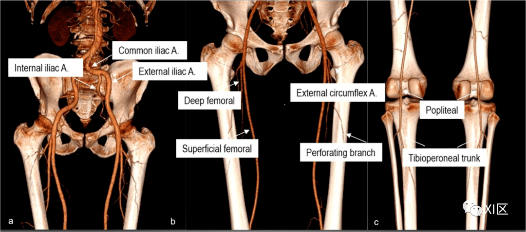下肢动脉解剖图谱CT图片