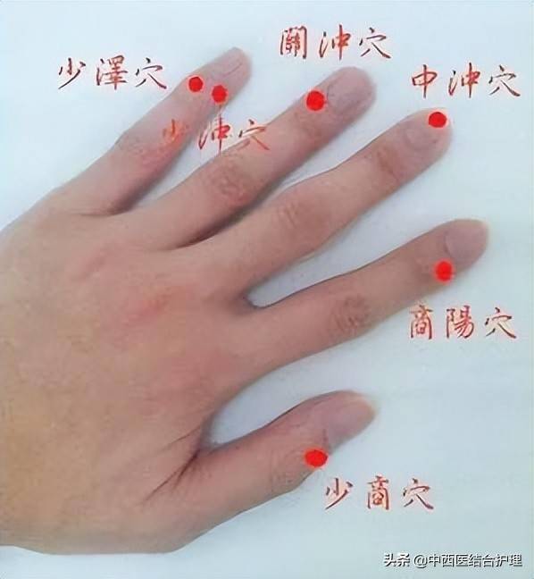 手指放血位置图图片