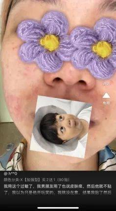 可取,张嘴呼吸的根本原因是咽腔,鼻腔狭小导致呼吸不足,如果封住嘴巴