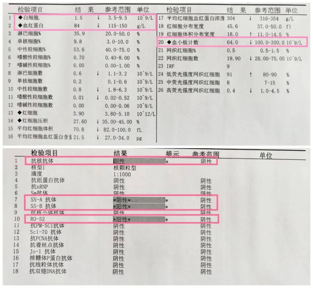 白細胞,血小板的數量都低於正常範圍),骨髓穿刺報告提示骨髓造血正常