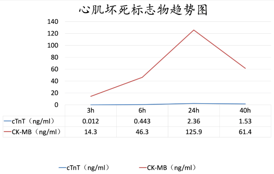 stemi溶栓61经典病例急性下壁心梗溶栓病例分享