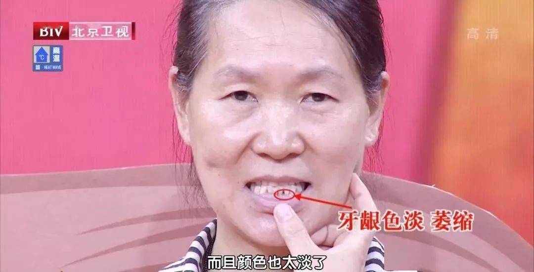 面色淡白无华或萎黄,气短懒言,眩晕心悸,神疲乏力,睡不好,健忘,唇爪色