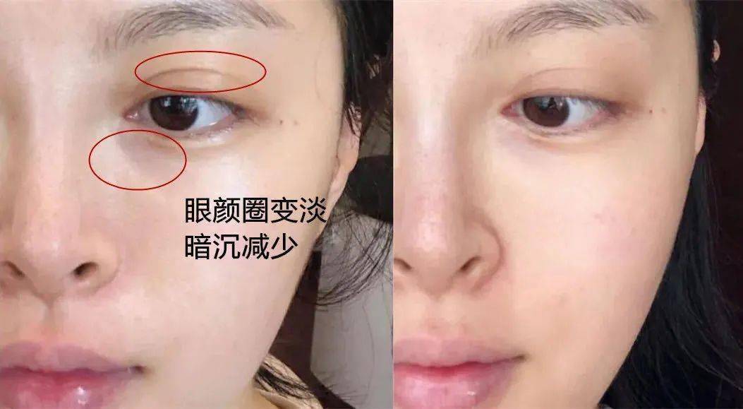 卖到断货 女明星都在用的熬夜眼霜 4周淡化细纹 绝了 欧莱雅 熨斗 全脸