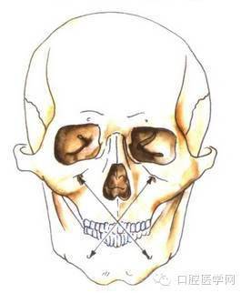 口腔頜面外科常用麻醉方法圖譜_cm_上頜_ml