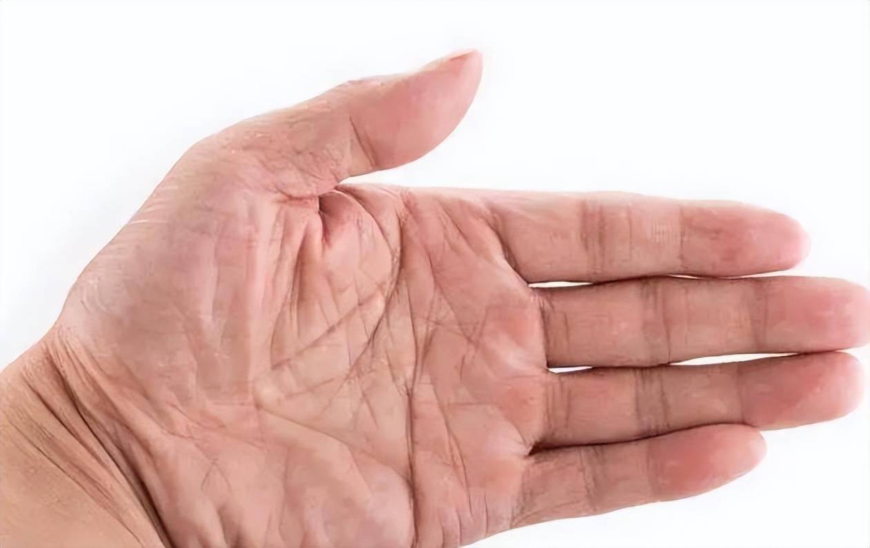 小宝宝手掌有横纹代表智力有问题来看看关于掌纹的秘密