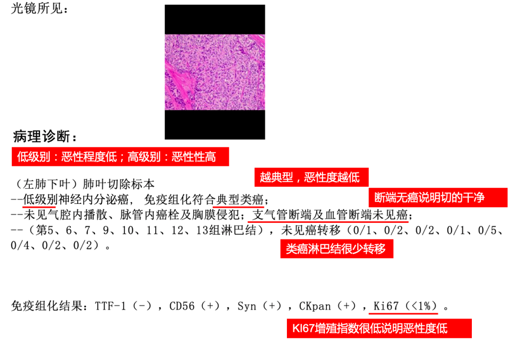 如何看懂肺癌【病理报告】?