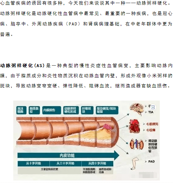 體外輸注幹細胞可修復損傷的血管預防動脈粥樣硬化