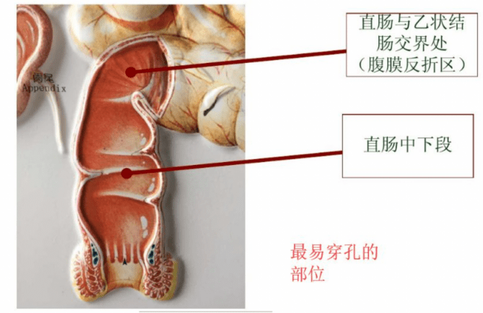 中医科普灌肠美容需谨慎