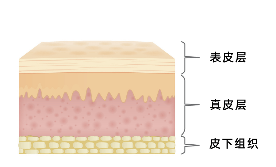 皮质下位置图片