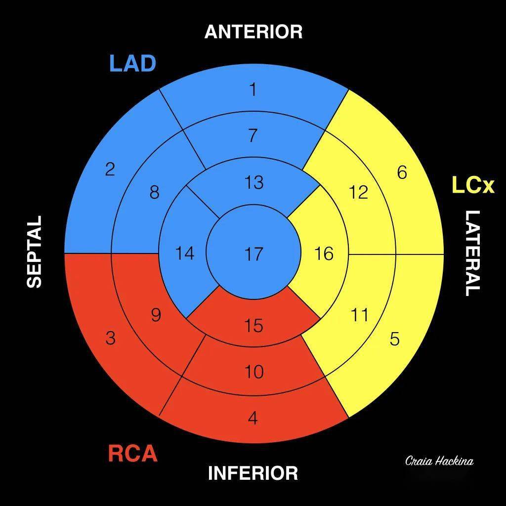心脏17段分法图片图片