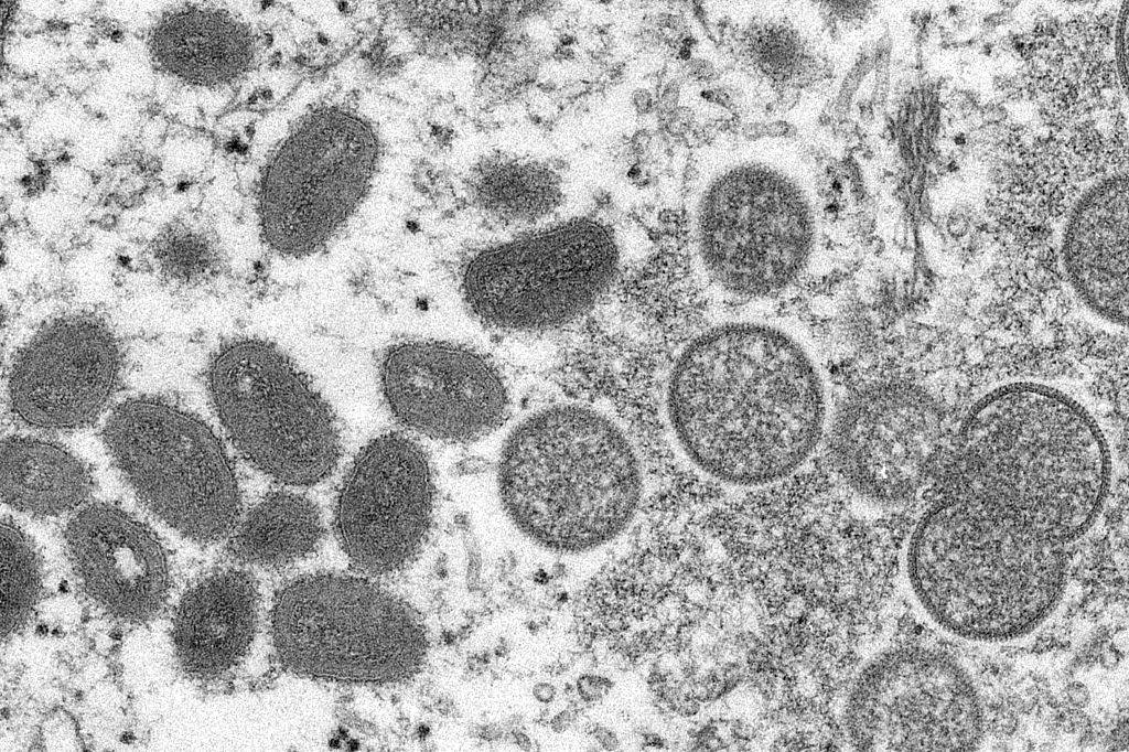 世卫组织：全球报告131例猴痘确诊病例、106例疑似病例