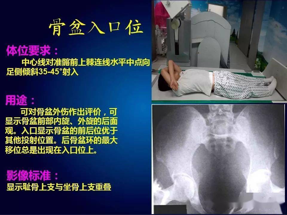 骨盆x线的摄片与测量_平台_版权_声明