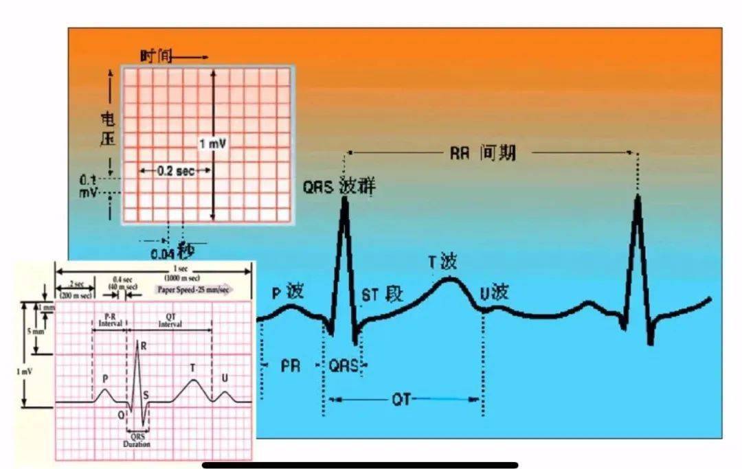 必看0基礎玩轉心電圖進階高手