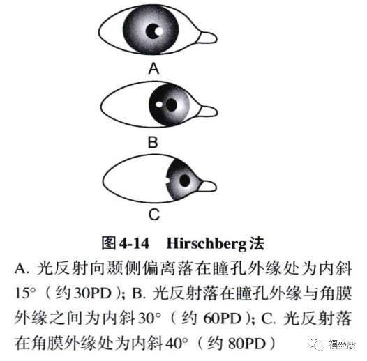 角膜反射弧图片