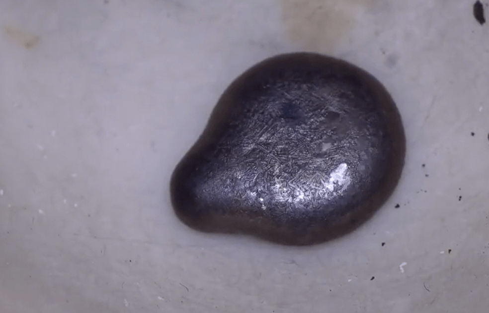 铊是究竟是啥毒性为啥那么强清华投毒案受害者几十年仍饱受折磨