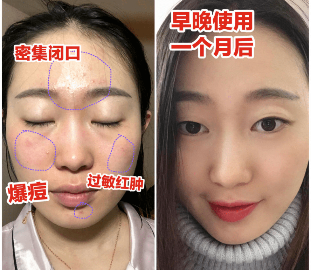 肌肤_皮肤_精华