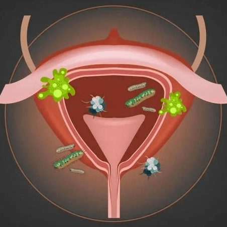 "卫生"习惯"不卫生",第三条90%的女生都会做……_女性_内裤_阴部