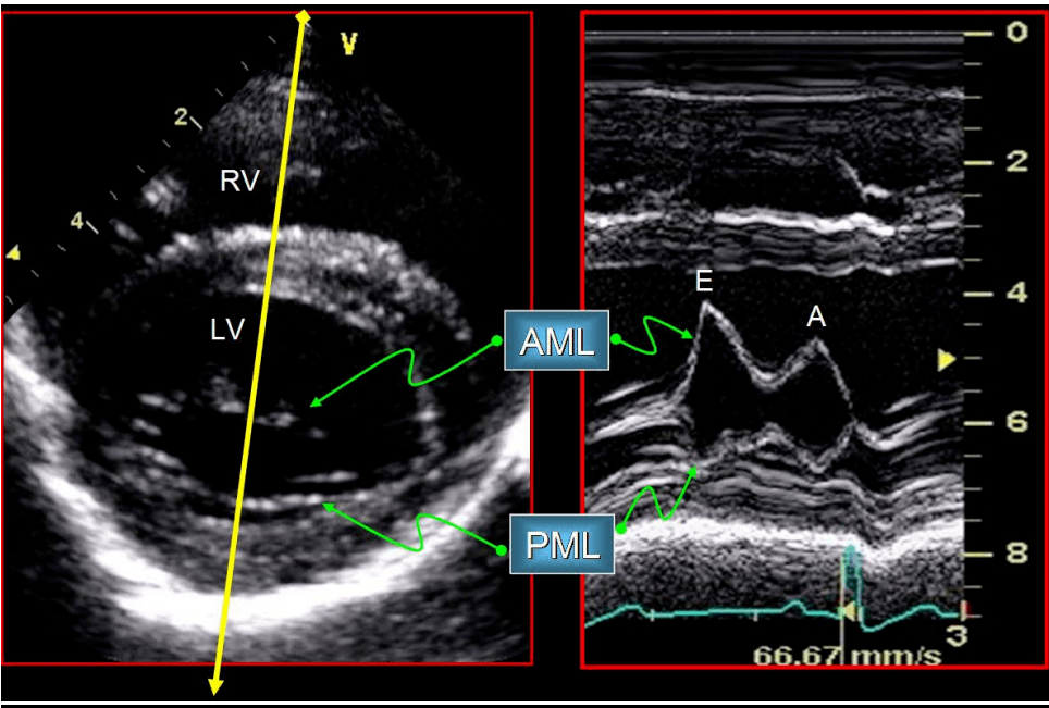 短轴切面右心室流出道水平胸骨旁右侧短轴切面左心房/主动脉水平胸骨